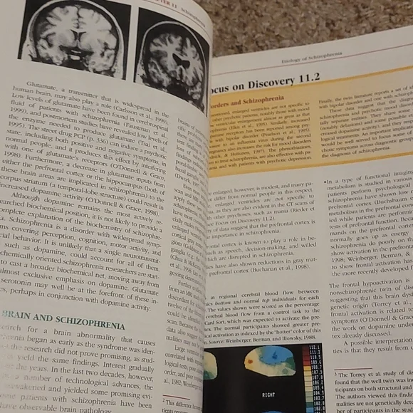 Abnormal Psychology 8th Edition copyright 2001 - Picture 6 of 9